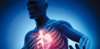 Inquinamento ed infarto: 11 volte più a rischio Un batterio intestinale complice dell’infarto